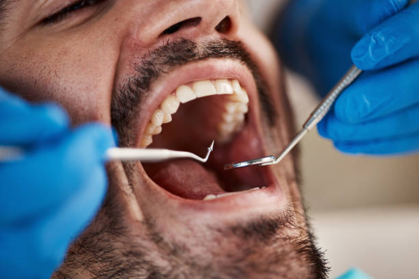 Best Emergency Gum Treatment in Hanamaulu, HI
